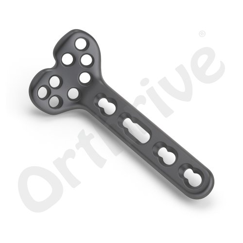 2.4mm Locking Volar Distal Radius Plate (8 Head Holes)